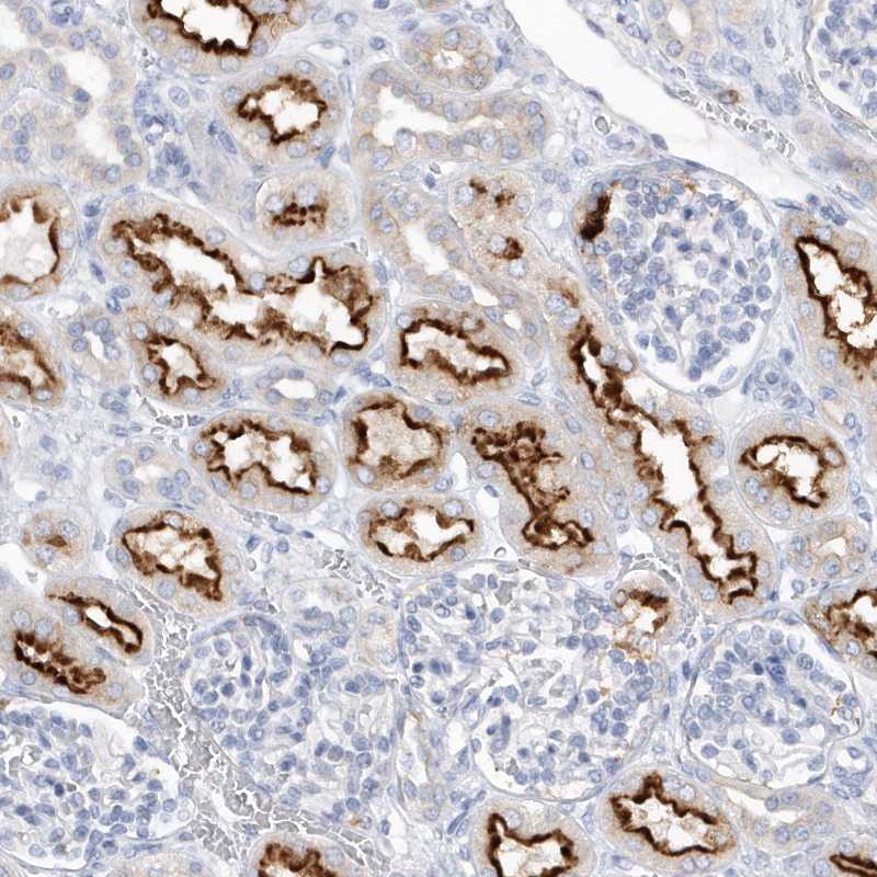 Atlas Antibodies Anti-RPE Antibody