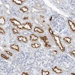 Atlas Antibodies Anti-RPE Antibody