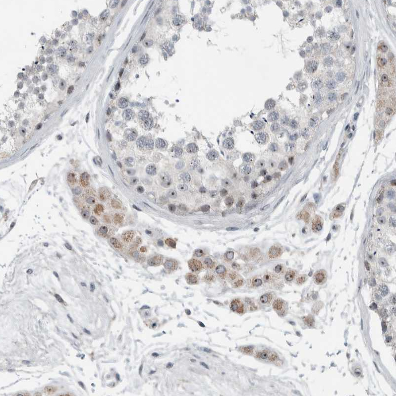Atlas Antibodies Anti-RPF1 Antibody