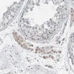 Atlas Antibodies Anti-RPF1 Antibody