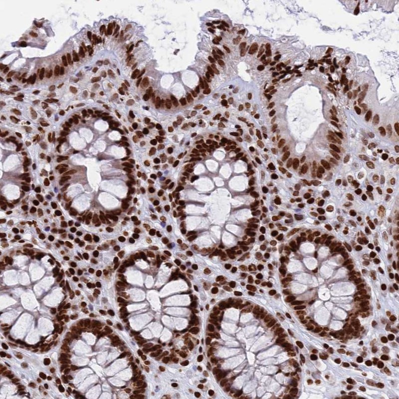 Atlas Antibodies Anti-RPAP1 Antibody