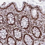 Atlas Antibodies Anti-RPAP1 Antibody
