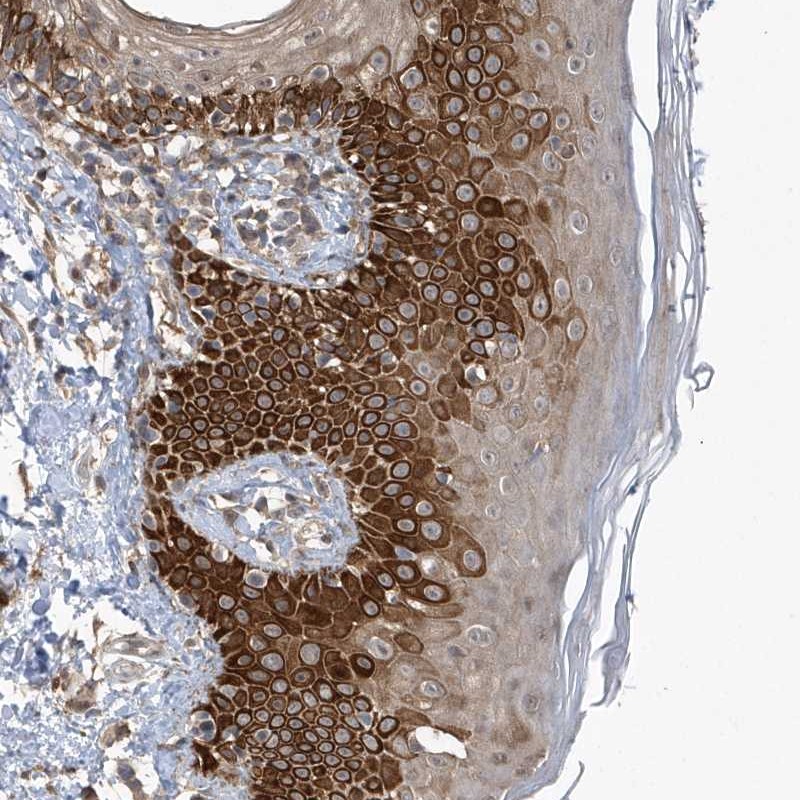 Atlas Antibodies Anti-RPE Antibody