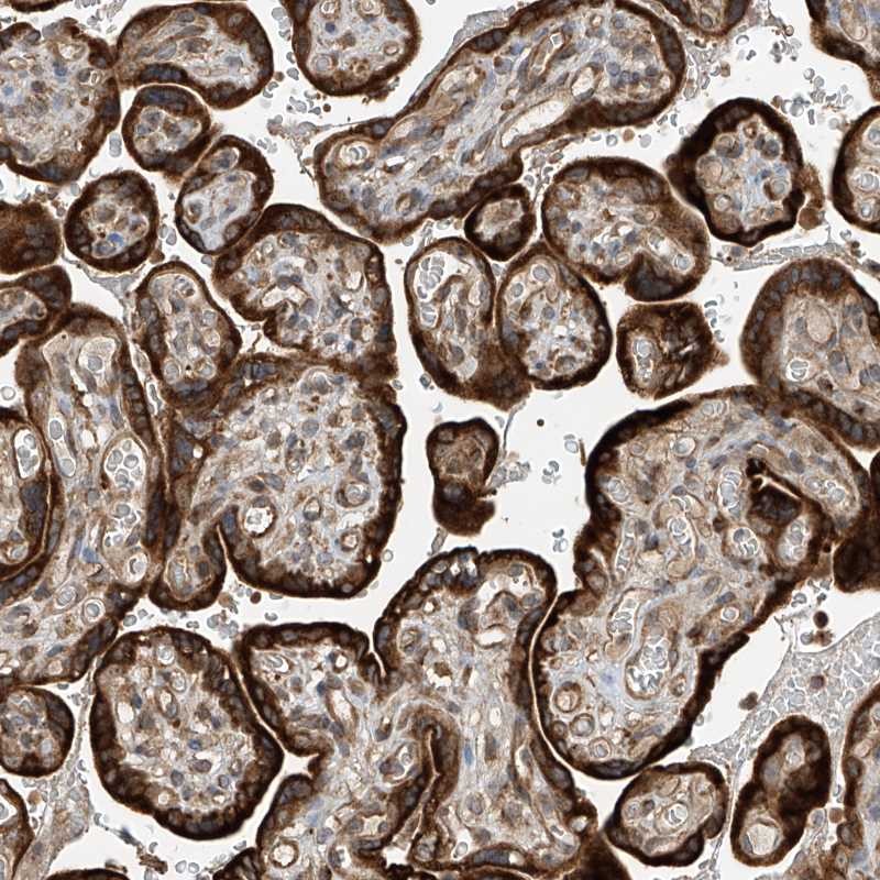 Atlas Antibodies Anti-RPAIN Antibody