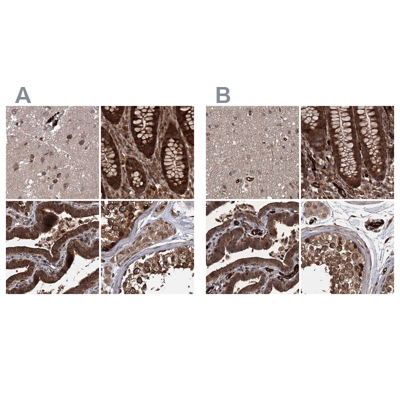 Atlas Antibodies Anti-RPAP3 Antibody
