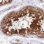 Atlas Antibodies Anti-RPAP2 Antibody