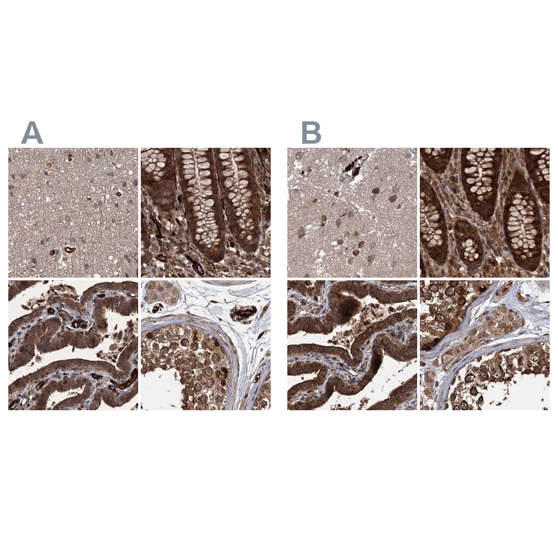 Atlas Antibodies Anti-RPAP3 Antibody