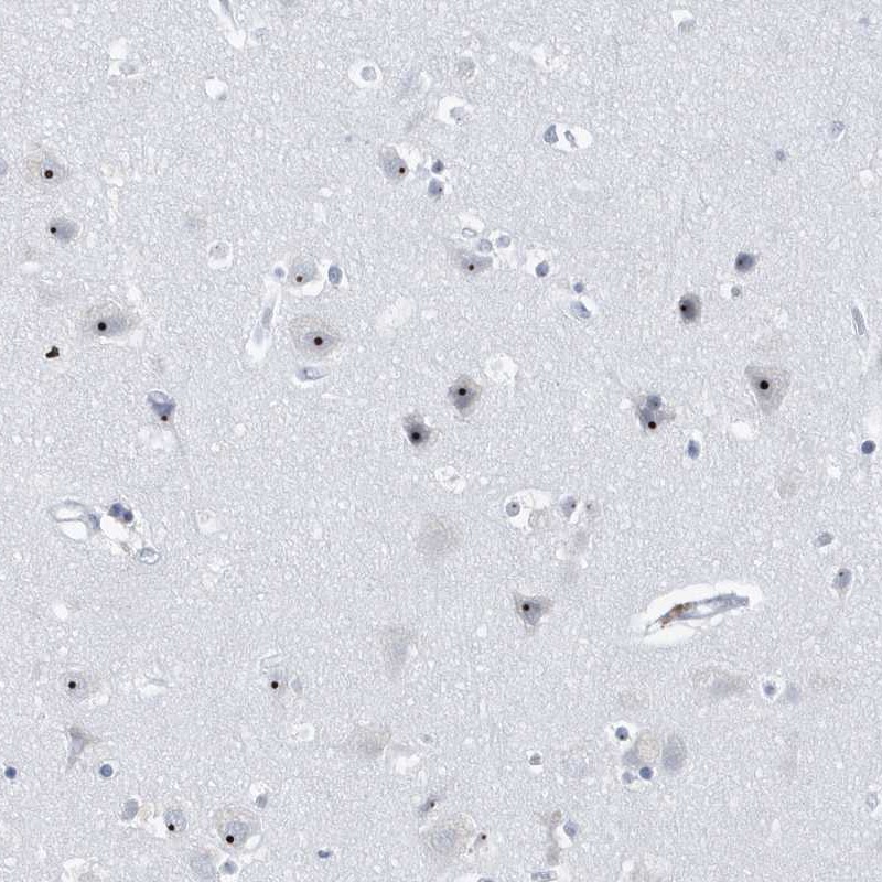 Atlas Antibodies Anti-RPF2 Antibody