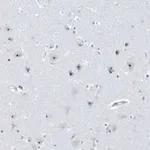 Atlas Antibodies Anti-RPF2 Antibody