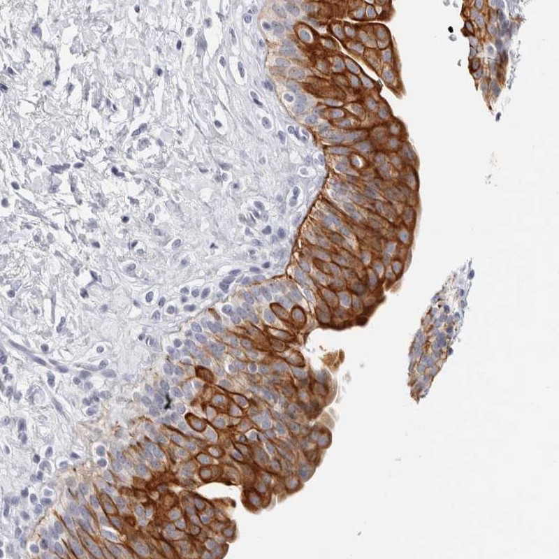 Atlas Antibodies Anti-RPH3AL Antibody