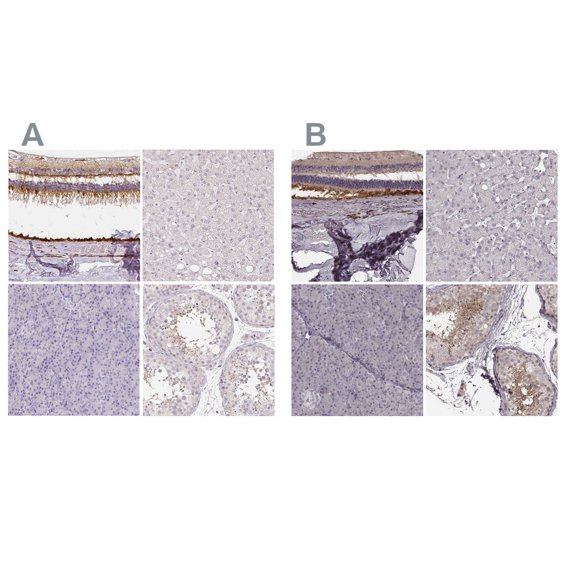 Atlas Antibodies Anti-RPGRIP1 Antibody
