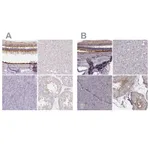 Atlas Antibodies Anti-RPGRIP1 Antibody