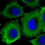 Atlas Antibodies Anti-RPGRIP1L Antibody