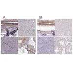 Atlas Antibodies Anti-RPGRIP1 Antibody