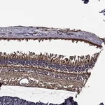 Atlas Antibodies Anti-RPGR Antibody