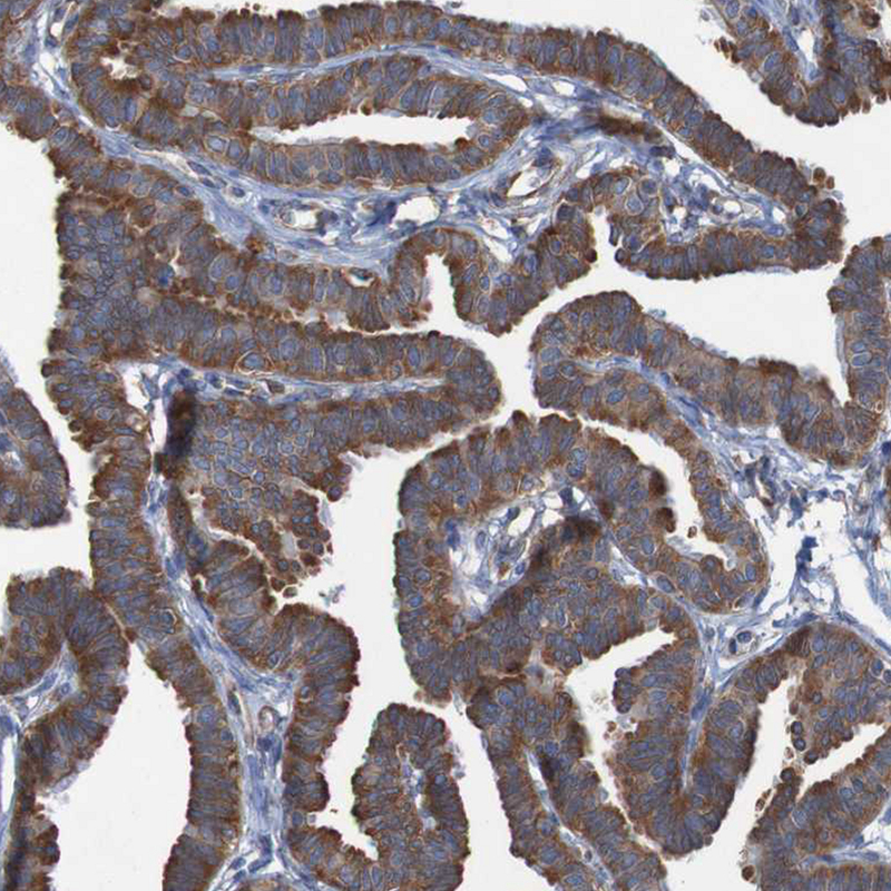 Atlas Antibodies Anti-RPL10 Antibody