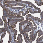 Atlas Antibodies Anti-RPL10 Antibody