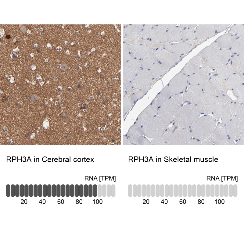 Atlas Antibodies Anti-RPH3A Antibody