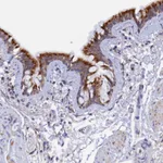 Atlas Antibodies Anti-RPGRIP1L Antibody