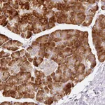 Atlas Antibodies Anti-RPL10A Antibody