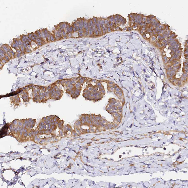 Atlas Antibodies Anti-RPL13A Antibody
