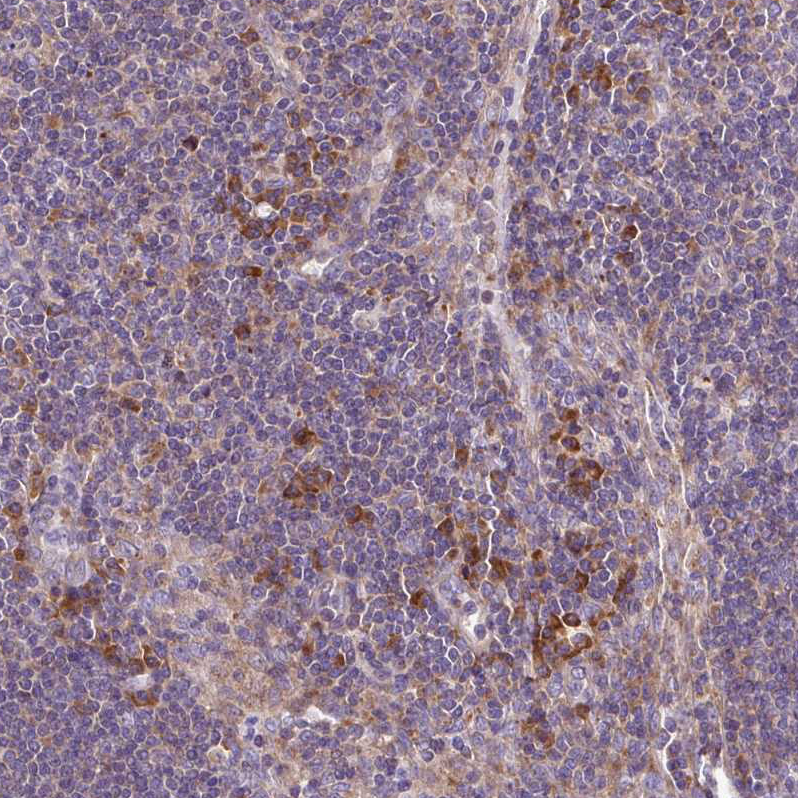 Atlas Antibodies Anti-RPL13 Antibody