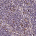 Atlas Antibodies Anti-RPL13 Antibody