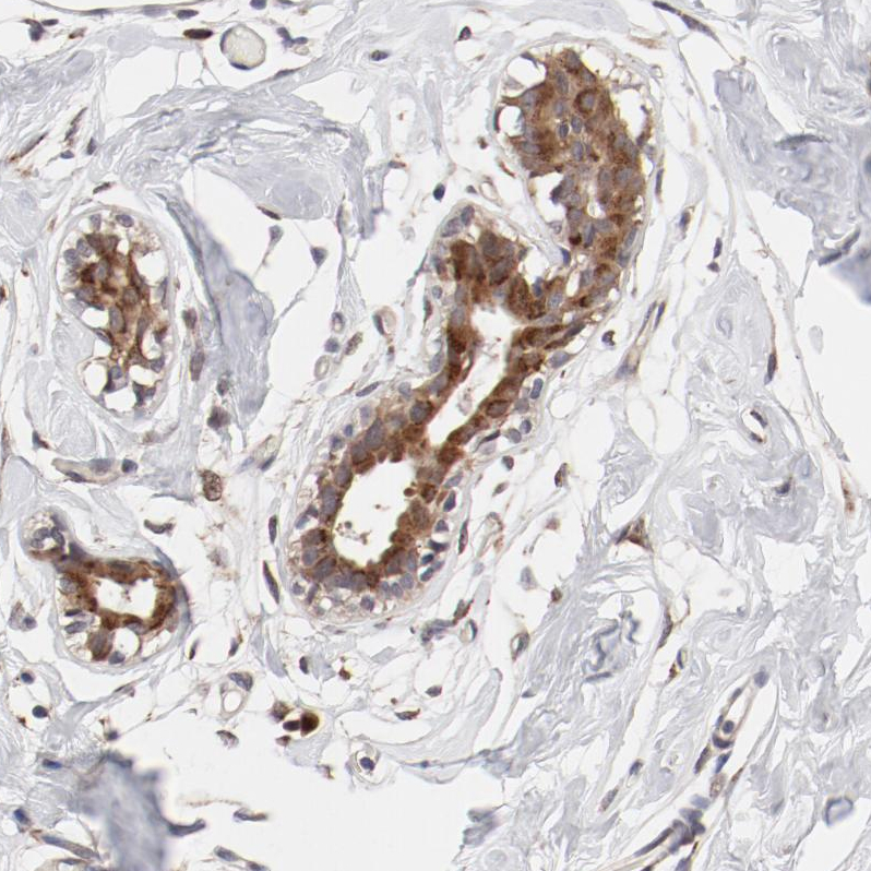 Atlas Antibodies Anti-RPL12 Antibody