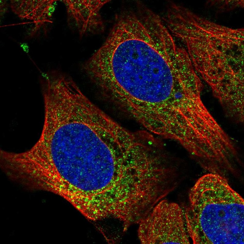 Atlas Antibodies Anti-RPL11 Antibody