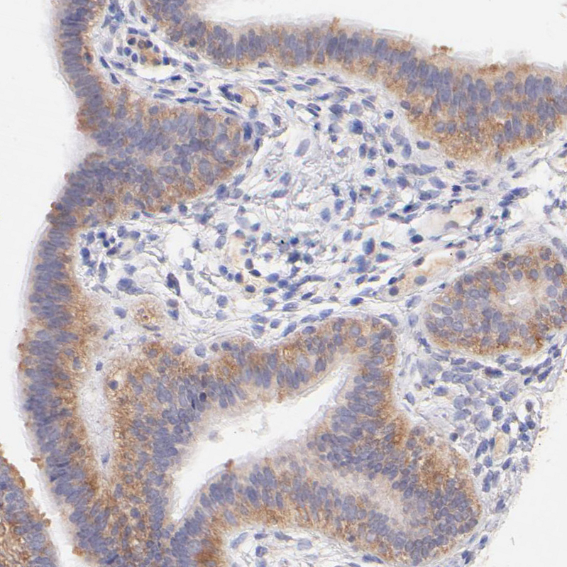Atlas Antibodies Anti-RPL11 Antibody