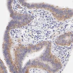 Atlas Antibodies Anti-RPL11 Antibody