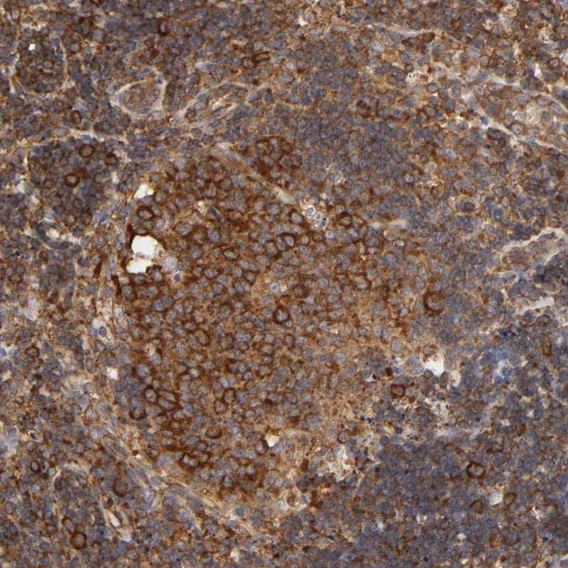 Atlas Antibodies Anti-RPL14 Antibody
