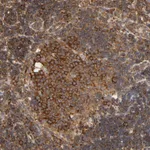 Atlas Antibodies Anti-RPL14 Antibody