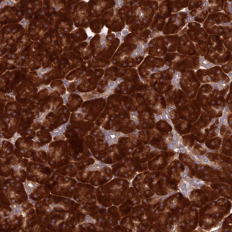 Atlas Antibodies Anti-RPL17 Antibody