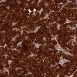 Atlas Antibodies Anti-RPL17 Antibody