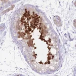 Atlas Antibodies Anti-RPL18 Antibody