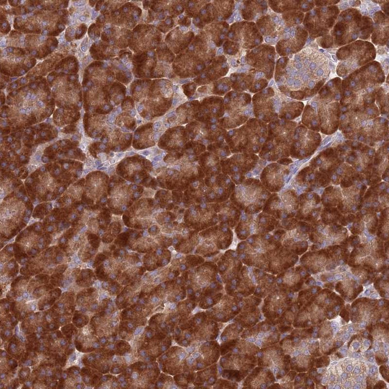 Atlas Antibodies Anti-RPL17 Antibody
