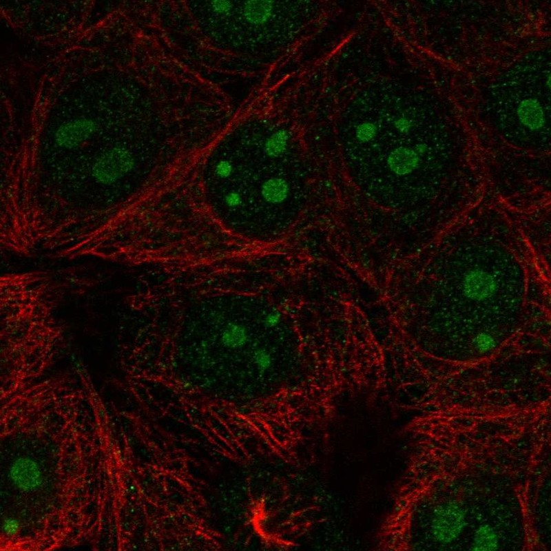 Atlas Antibodies Anti-RPL22L1 Antibody