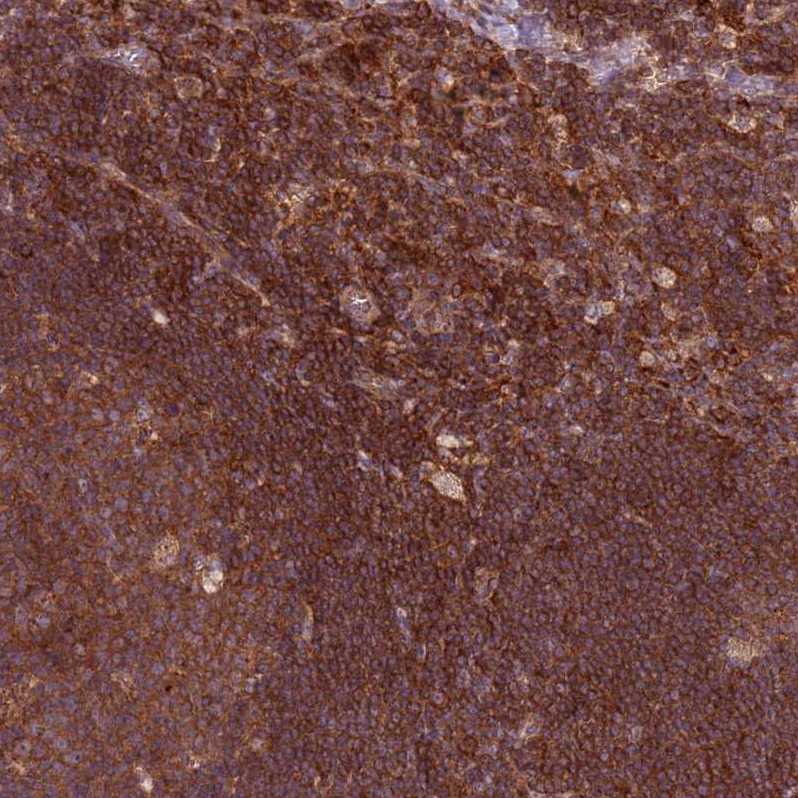 Atlas Antibodies Anti-RPL21 Antibody