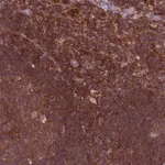 Atlas Antibodies Anti-RPL21 Antibody