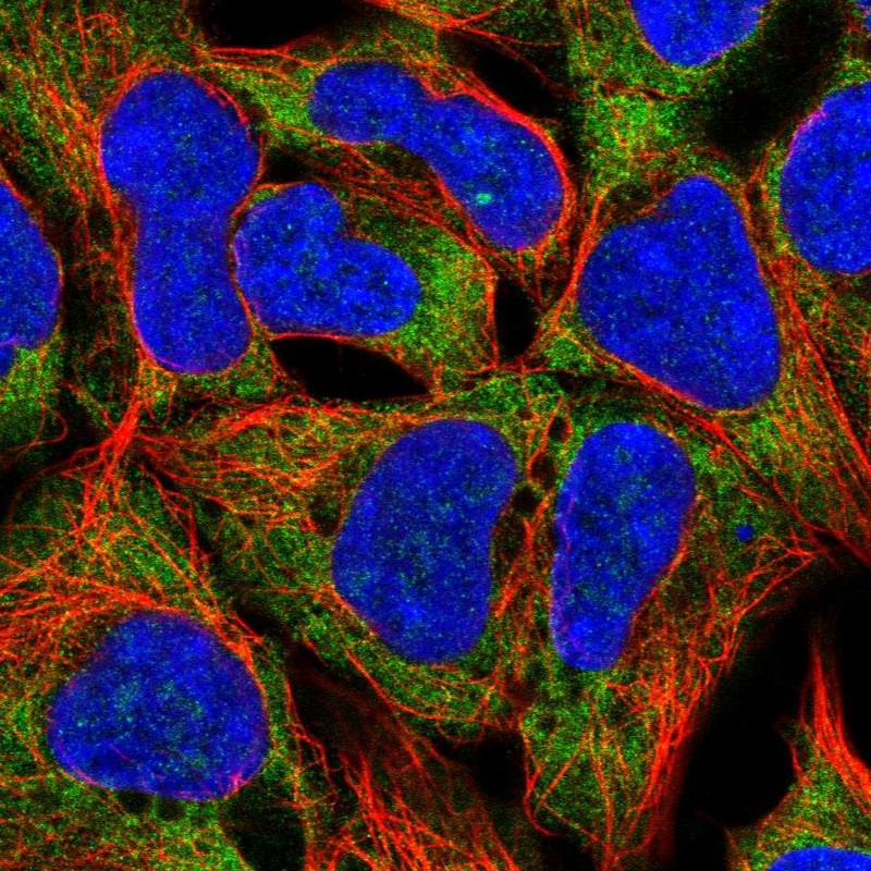 Atlas Antibodies Anti-RPL19 Antibody