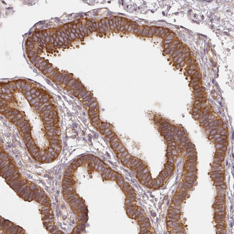 Atlas Antibodies Anti-RPL24 Antibody