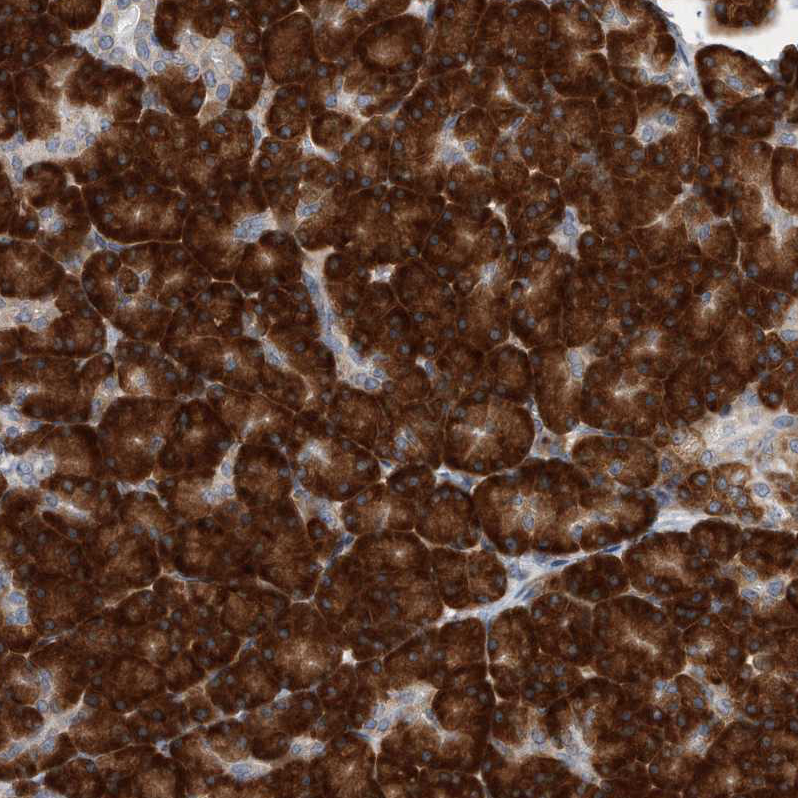Atlas Antibodies Anti-RPL26 Antibody