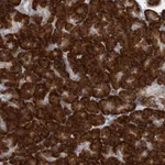 Atlas Antibodies Anti-RPL26 Antibody