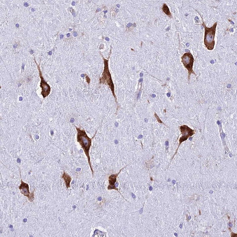 Atlas Antibodies Anti-RPL19 Antibody