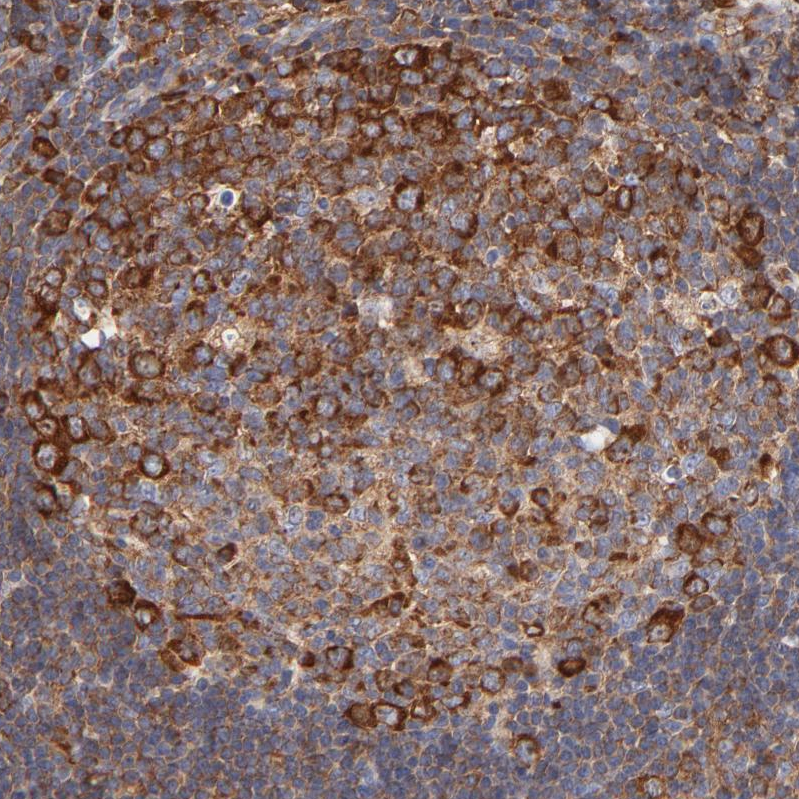 Atlas Antibodies Anti-RPL27 Antibody