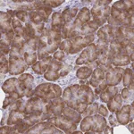 Atlas Antibodies Anti-RPL27A Antibody