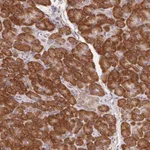 Atlas Antibodies Anti-RPL27A Antibody