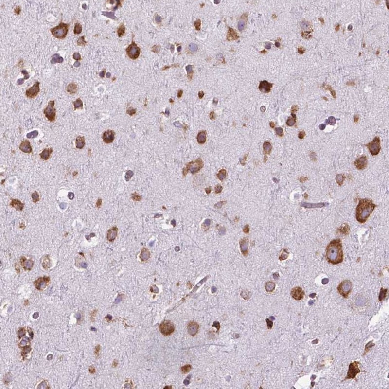 Atlas Antibodies Anti-RPL29 Antibody