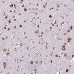 Atlas Antibodies Anti-RPL29 Antibody